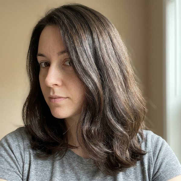 Après — Cheveux visiblement plus fournis